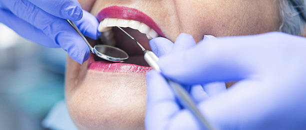 Best Emergency Dental Care for Broken or Chipped Teeth in Pasadena, CA